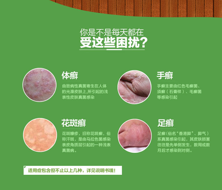 鹽酸特比萘芬噴霧劑價格