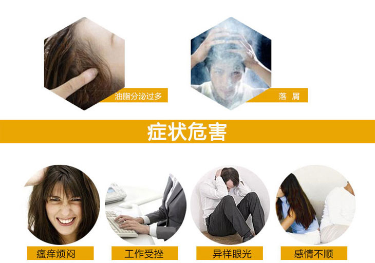 除脂生發片價格