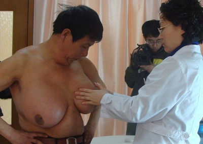 乳腺